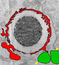 細胞内に入ったDNAビーズの電子顕微鏡写真　赤は核膜に似た膜。緑はオートファジー関連の膜。